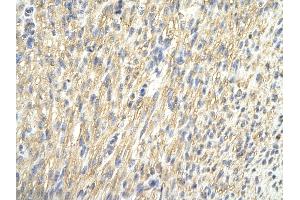 Rabbit Anti-CDK4 antibody Catalog Number: ARP30259_P050  Paraffin Embedded Tissue: Human Heart cell  Cellular Data: Epithelial cells of renal tubule Antibody Concentration:  4. (CDK4 antibody  (C-Term))