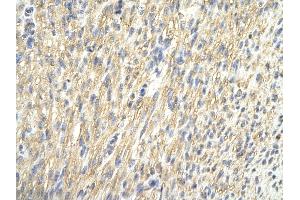 Rabbit Anti-CDK4 antibody Catalog Number: ARP30259_P050  Paraffin Embedded Tissue: Human Heart cell  Cellular Data: Epithelial cells of renal tubule Antibody Concentration:  4.