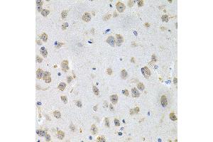 Immunohistochemistry of paraffin-embedded mouse brain using GNE antibody (ABIN5996449) at dilution of 1/100 (40x lens).