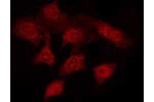 ABIN6272236 staining HEPG2 by IF/ICC. (Acrosin antibody  (N-Term))