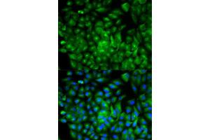 Immunofluorescence analysis of A549 cell using ATG16L1 antibody. (ATG16L1 antibody  (AA 90-300))