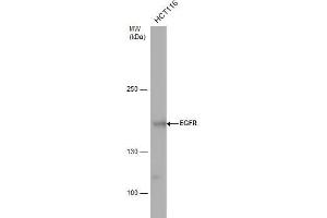 WB Image EGFR antibody detects EGFR protein by western blot analysis. (EGFR antibody  (N-Term))