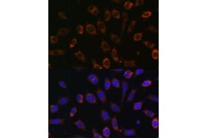 Immunofluorescence analysis of L929 cells using TCIRG1 Polyclonal Antibody (ABIN7270707) at dilution of 1:100 (40x lens). (TCIRG1 antibody  (AA 1-130))