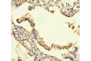 Immunohistochemistry of paraffin-embedded human lung tissue using ABIN7168811 at dilution of 1:100 (SEMA5A antibody  (AA 201-400))