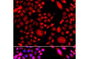 Immunofluorescence analysis of A549 cells using RAC3 Polyclonal Antibody (RAC3 antibody)
