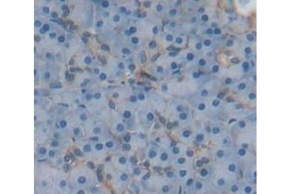 ADAM20 antibody  (AA 367-615)