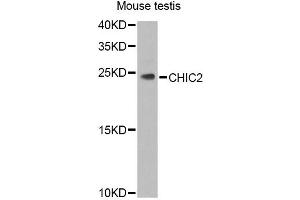 Western blot analysis of extracts of mouse testis, using CHIC2 Antibody.
