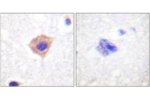Immunohistochemistry analysis of paraffin-embedded human brain tissue, using Catalase (Ab-385) Antibody. (Catalase antibody  (AA 361-410))