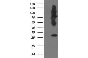 HEK293T cells were transfected with the pCMV6-ENTRY control (Left lane) or pCMV6-ENTRY SNAP25 (Right lane) cDNA for 48 hrs and lysed. (SNAP25 antibody)
