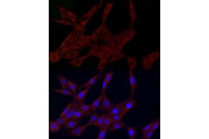 Immunofluorescence analysis of PC-12 cells using PLK2 Rabbit pAb (ABIN6132905, ABIN6145776, ABIN6145778 and ABIN6222860) at dilution of 1:150 (40x lens). (PLK2 antibody  (AA 322-671))