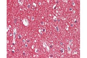 Human Brain, Cortex: Formalin-Fixed, Paraffin-Embedded (FFPE), at a concentration of 5 ug/ml. (ICAM5 antibody  (AA 874-924))