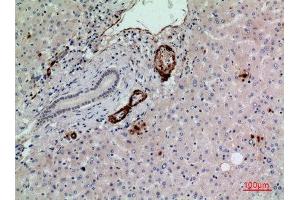Immunohistochemistry (IHC) analysis of paraffin-embedded Human Liver, antibody was diluted at 1:100. (RHAG antibody  (N-Term))