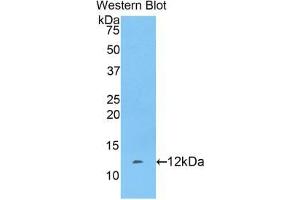 Western blot analysis of the recombinant protein. (FGA antibody  (AA 554-655))