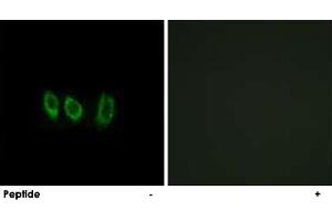 Immunofluorescence analysis of A-549 cells, using CSTL1 polyclonal antibody .