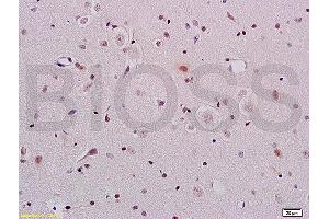 Formalin-fixed and paraffin embedded rat brain tissue labeled with Anti-ERCC1 Polyclonal Antibody, Unconjugated (ABIN733553) at 1:200 followed by conjugation to the secondary antibody and DAB staining