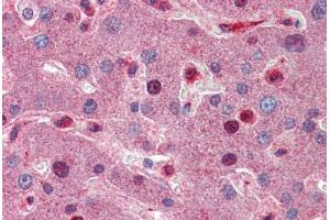 Human Liver: Formalin-Fixed, Paraffin-Embedded (FFPE) (C8B antibody  (AA 451-500))