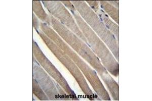 TRMT2B Antibody (N-term) (ABIN655117 and ABIN2844748) immunohistochemistry analysis in formalin fixed and paraffin embedded human skeletal muscle followed by peroxidase conjugation of the secondary antibody and DAB staining. (TRMT2B antibody  (N-Term))