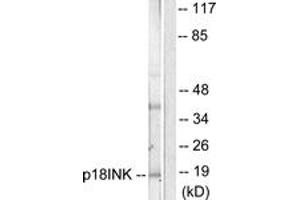 Western blot analysis of extracts from COS7 cells, using p18 INK Antibody. (P18 INK antibody  (AA 111-160))