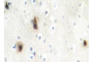 Immunohistochemistry analyzes of MVK antibody in paraffin-embedded human brain tissue. (MVK antibody)