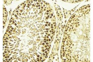 ABIN6267669 at 1/100 staining Mouse testis tissue by IHC-P. (CAMK4 antibody  (pThr200))