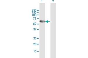 Western Blot analysis of TERF1 expression in transfected 293T cell line by TERF1 MaxPab polyclonal antibody. (TRF1 antibody  (AA 1-439))