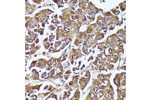 Immunohistochemistry (IHC) image for anti-Aldo-keto Reductase Family 1, Member C2 (AKR1C2) (AA 1-323) antibody (ABIN7265549)