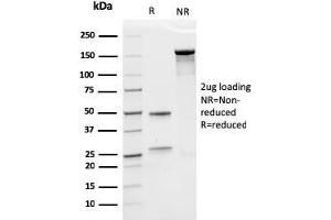 SDS-PAGE Analysis Purified EPO Recombinant Mouse Monoclonal Antibody (rEPO/1367). (Recombinant EPO antibody  (AA 28-162))
