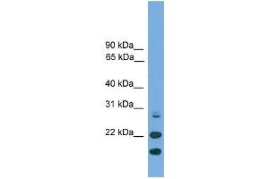 WB Suggested Anti-ASF1A Antibody Titration: 0. (ASF1A antibody  (N-Term))