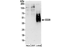 Western Blotting (WB) image for anti-CD28 (CD28) (AA 1-50) antibody (ABIN7449695)