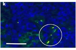 IF Validation of Envelope in COVID-19 Patient Skin: (Magro et al. (SARS-CoV-2 Envelope antibody  (N-Term))