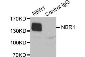 Immunoprecipitation analysis of extracts of K562 cells, using NBR1 antibody (ABIN5972123).