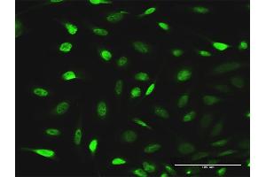 Immunofluorescence of purified MaxPab antibody to EPB41L1 on HeLa cell.