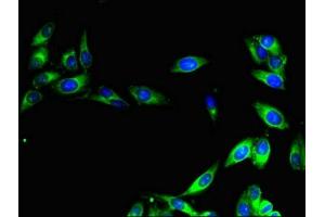 Immunofluorescent analysis of Hela cells using ABIN7147222 at dilution of 1:100 and Alexa Fluor 488-congugated AffiniPure Goat Anti-Rabbit IgG(H+L)
