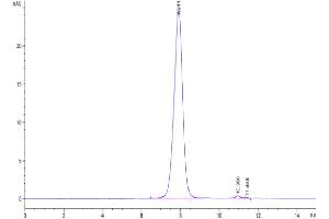The purity of SARS-CoV-2 Spike S1 (Gamma P. (SARS-CoV-2 Spike S1 Protein (P.1 - gamma) (His tag))