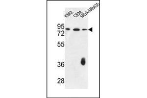Western blot analysis of F12 Antibody (N-term) in K562,CEM,MDA-MB435 cell line lysates (35ug/lane).