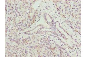 Immunohistochemistry of paraffin-embedded human pancreatic tissue using ABIN7148645 at dilution of 1:100 (CMC1 antibody  (AA 1-106))