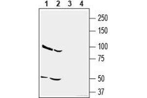 Western blot analysis of human U-87 MG glioblastoma cell line lysate (lanes 1 and 3) and human MDA-MB-231 breast adenocarcinoma cell line lysate (lanes 2 and 4): - 1,2. (CD73 antibody  (Extracellular, N-Term))