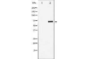 Western blot analysis of RelB phosphorylation expression in HepG2 whole cell lysates,The lane on the left is treated with the antigen-specific peptide.