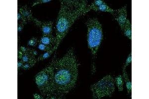 Confocal immunofluorescent analysis of NOTCH3 antibody with HepG2 cells followed by Alexa Fluor 488-conjugated goat anti-rabbit lgG (green). (NOTCH3 antibody  (AA 2291-2321))