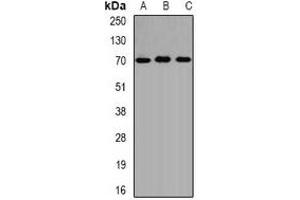 Western blot analysis of ALAS-H expression in SW620 (A), HepG2 (B), mouse liver (C) whole cell lysates. (ALAS1 antibody)
