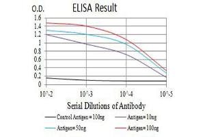 Black line: Control Antigen (100 ng),Purple line: Antigen (10 ng), Blue line: Antigen (50 ng), Red line:Antigen (100 ng) (CCR1 antibody)