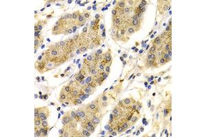 Immunohistochemistry of paraffin-embedded Human gastric using PRG2 antibody at dilution of 1:100 (x400 lens). (PRG2 antibody  (AA 17-222))