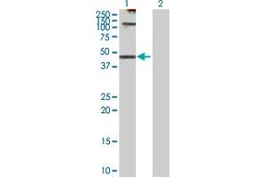 Western Blot analysis of KRT18 expression in transfected 293T cell line by KRT18 MaxPab polyclonal antibody. (Cytokeratin 18 antibody  (AA 1-430))