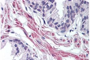 Human Prostate (formalin-fixed, paraffin-embedded) stained with FNTA antibody ABIN298038 at 10 ug/ml followed by biotinylated goat anti-rabbit IgG secondary antibody ABIN481713, alkaline phosphatase-streptavidin and chromogen. (FNTA antibody  (AA 150-250))