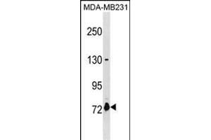ASNSD1 Antibody (Center) (ABIN1881075 and ABIN2838601) western blot analysis in MDA-M cell line lysates (35 μg/lane). (ASNSD1 antibody  (AA 380-406))