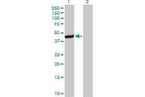 Western Blot analysis of CTH expression in transfected 293T cell line by CTH monoclonal antibody (M01A), clone 4E1-1B7.