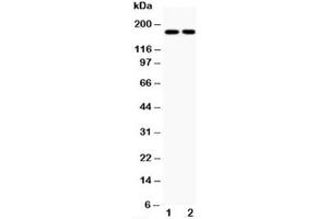 Western blot testing of Topoisomerase II alpha antibody and Lane 1:  HeLa (Topoisomerase II alpha antibody  (C-Term))