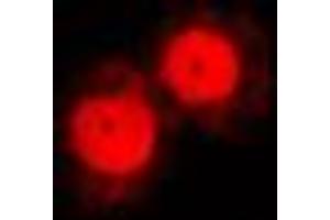 Immunofluorescent analysis of Annexin A1 staining in NIH3T3 cells. (Annexin a1 antibody  (Center))