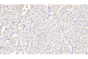 Detection of SSA1 in Human Cardiac Muscle Tissue using Polyclonal Antibody to Sjogren Syndrome Antigen A1 (SSA1) (TRIM21 antibody  (AA 268-465))