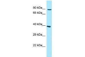 WB Suggested Anti-GPLD1 Antibody Titration: 1. (GPLD1 antibody  (N-Term))